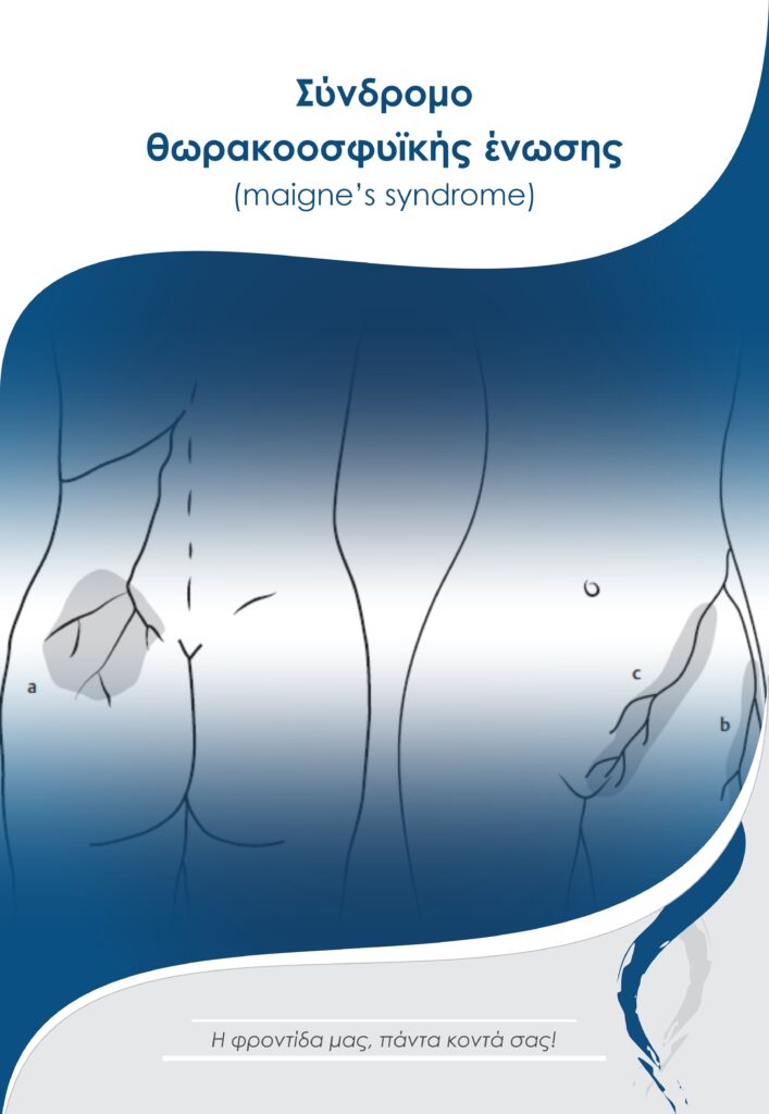 Σύνδρομο Θωρακοοσφυϊκής ένωσης(Maigne’s syndrome)