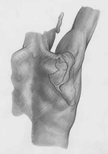 Wmoplath4